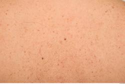 Photo Textures of Human Skin